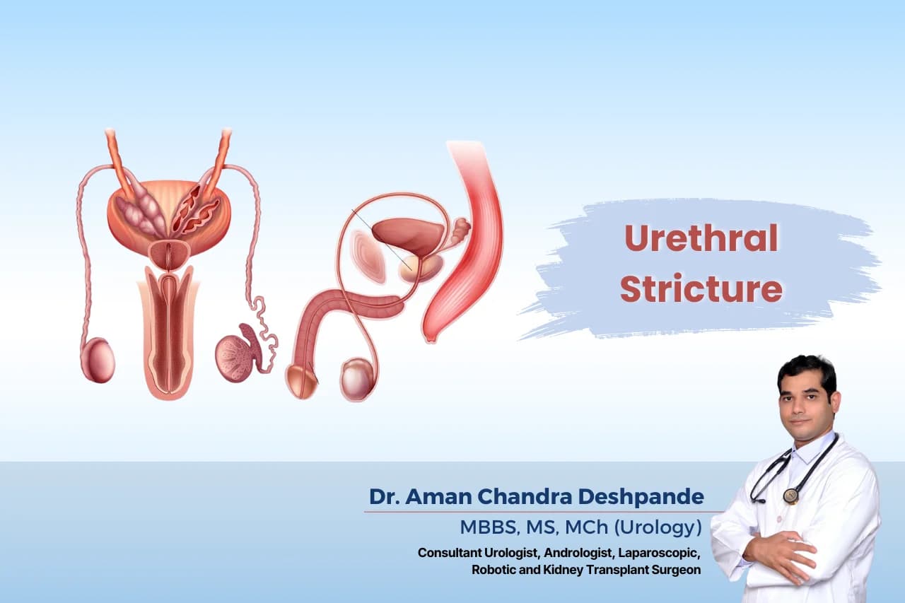 Urethral stricture best treatment by Dr Aman Chandra Deshpande in Hyderabad