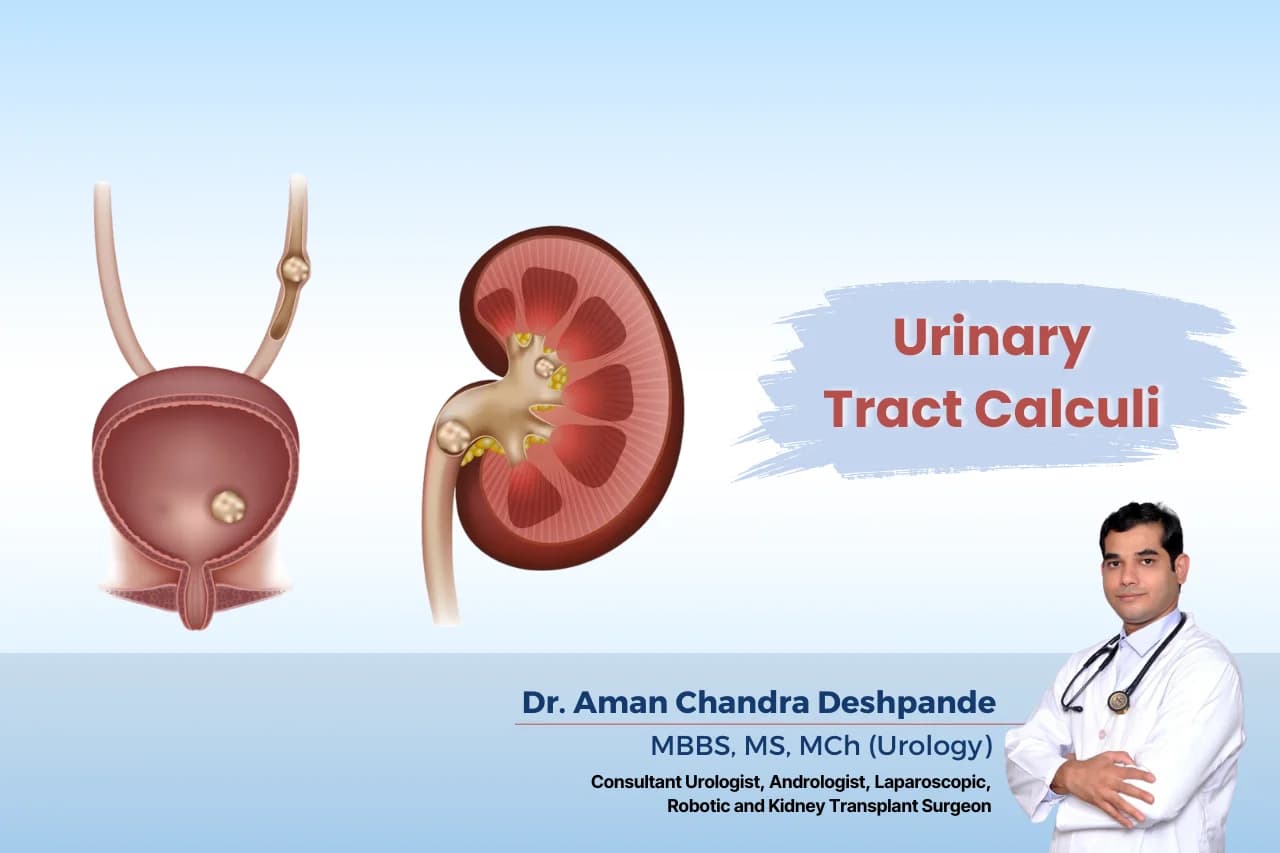 Urinary tract calculi treatment by Dr Aman Chandra Deshpande in Hyderabad