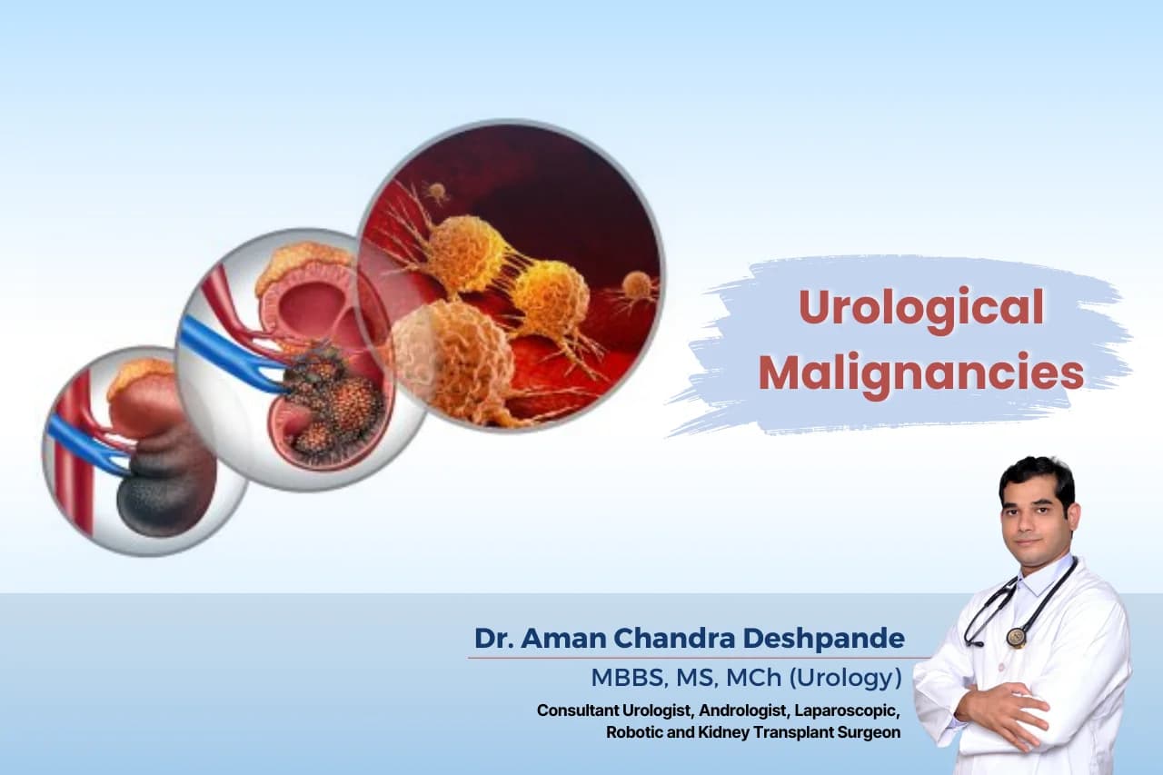 Urological malignancies best treatment by Dr Aman Chandra Deshpande, Hyderabad